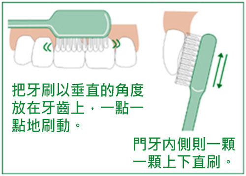 蛀牙和正確刷牙方法 蛀牙和正確刷牙方法